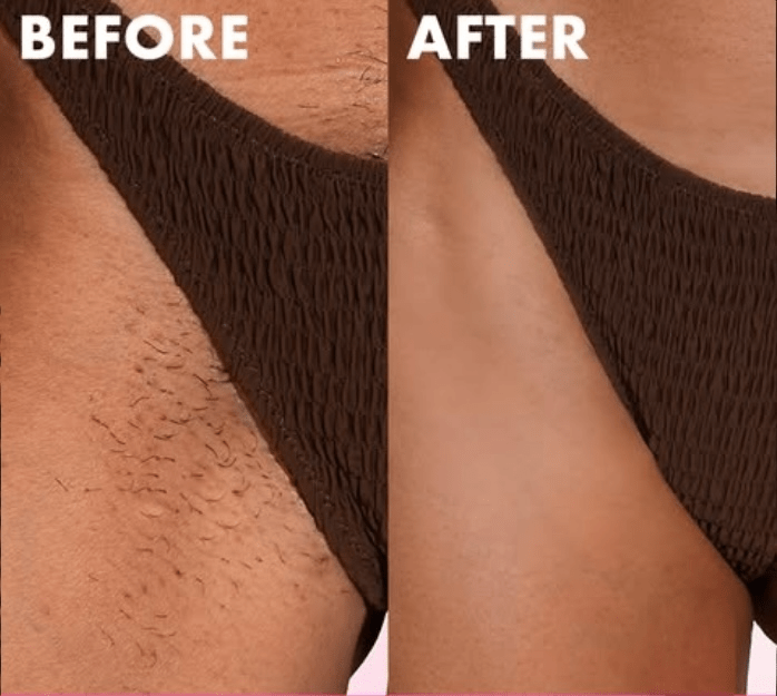 Intimate Shaving Kit - For Sensitive Areas (Bikini, Underarms and Booty) - Essentials by Jay