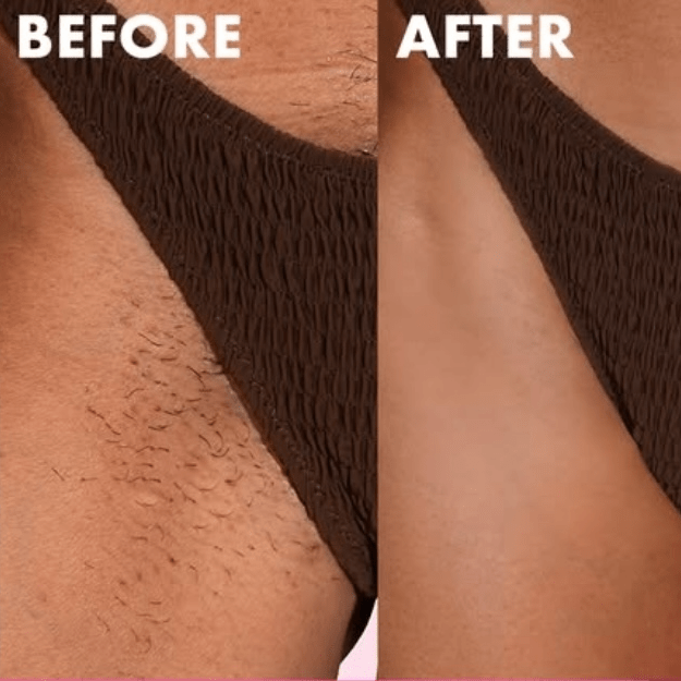 Intimate Shaving Kit for Sensitive Bikini, Underarm and Booty Areas | Essentials by Jay