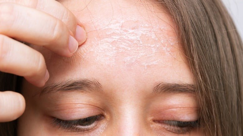 Say Goodbye to Dry Winter Skin: Tips and Solutions - Essentials by Jay