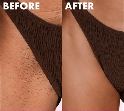 Intimate Shaving Kit - For Sensitive Areas (Bikini, Underarms and Booty) - Essentials by Jay